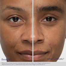 Load image into Gallery viewer, Obagi Nu-Cil® Eyebrow Boosting Serum 5ml
